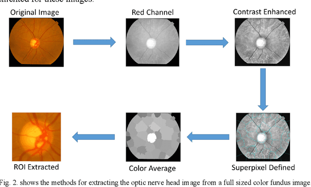 Figure 3 for Rapid Classification of Glaucomatous Fundus Images