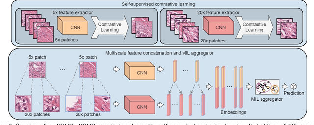 Figure 3 for Dual-stream Multiple Instance Learning Network for Whole Slide Image Classification with Self-supervised Contrastive Learning