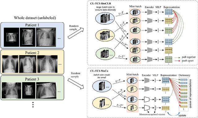 Figure 1 for Contrastive Learning with Temporal Correlated Medical Images: A Case Study using Lung Segmentation in Chest X-Rays