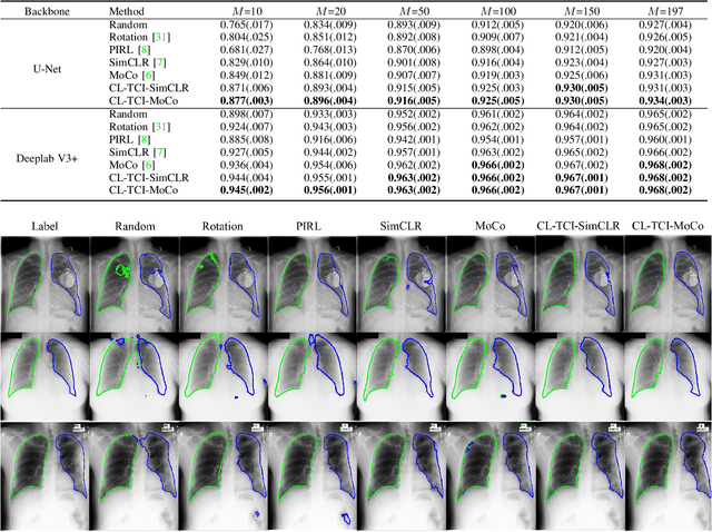 Figure 2 for Contrastive Learning with Temporal Correlated Medical Images: A Case Study using Lung Segmentation in Chest X-Rays