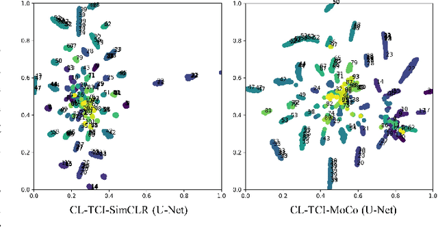 Figure 3 for Contrastive Learning with Temporal Correlated Medical Images: A Case Study using Lung Segmentation in Chest X-Rays