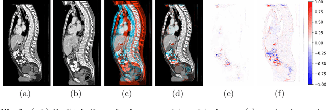 Figure 2 for Fully-deformable 3D image registration in two seconds