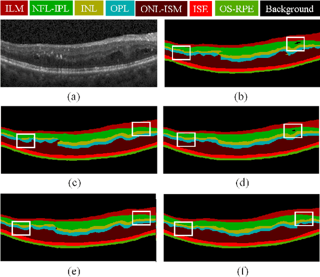 Figure 2 for MPG-Net: Multi-Prediction Guided Network for Segmentation of Retinal Layers in OCT Images