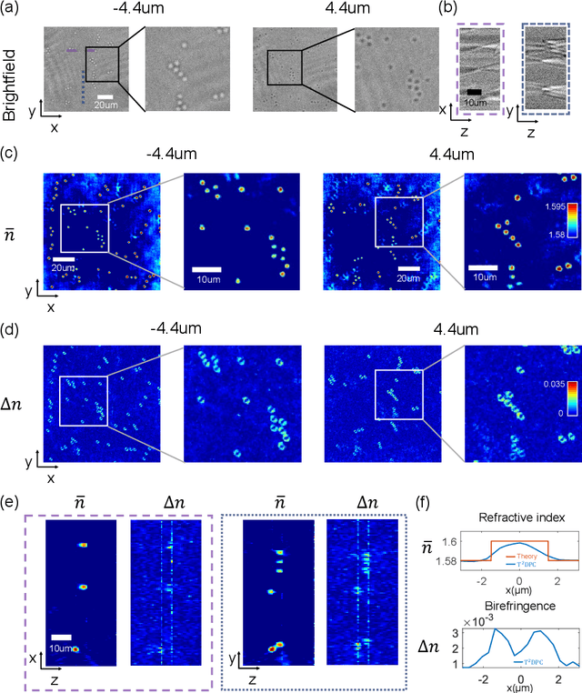 Figure 3 for Tensorial tomographic differential phase-contrast microscopy