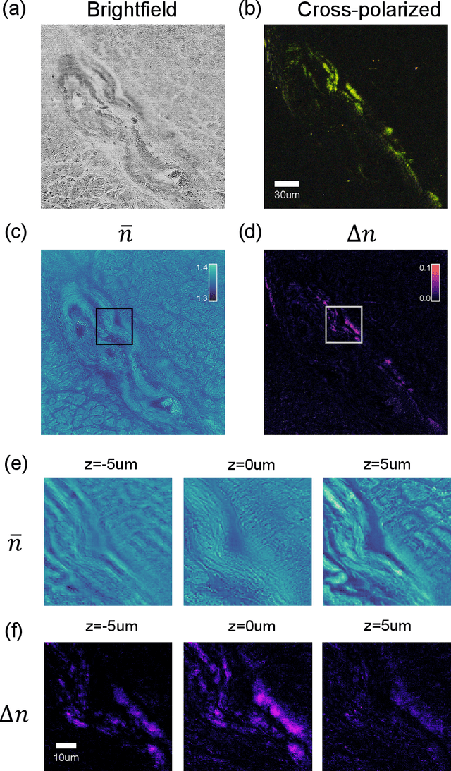 Figure 4 for Tensorial tomographic differential phase-contrast microscopy