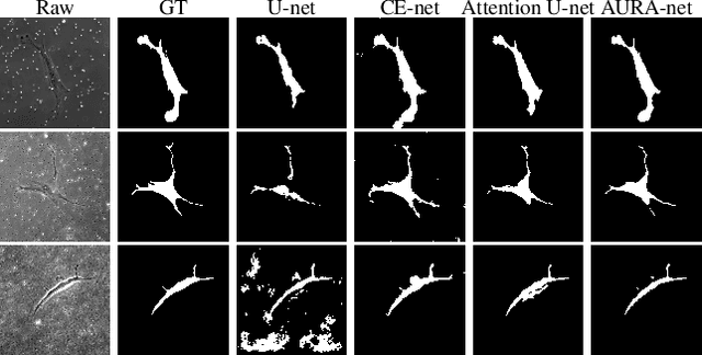 Figure 4 for aura-net : robust segmentation of phase-contrast microscopy images with few annotations