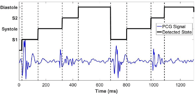 Figure 3 for Phonocardiographic Sensing using Deep Learning for Abnormal Heartbeat Detection