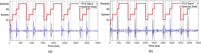 Figure 4 for Phonocardiographic Sensing using Deep Learning for Abnormal Heartbeat Detection