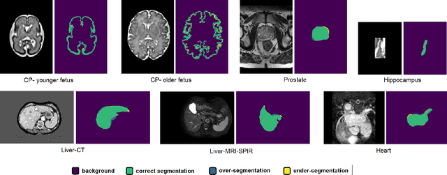 Figure 3 for Improving Calibration and Out-of-Distribution Detection in Medical Image Segmentation with Convolutional Neural Networks