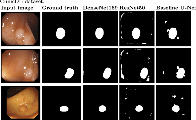 Figure 4 for Automatic Polyp Segmentation Using Convolutional Neural Networks