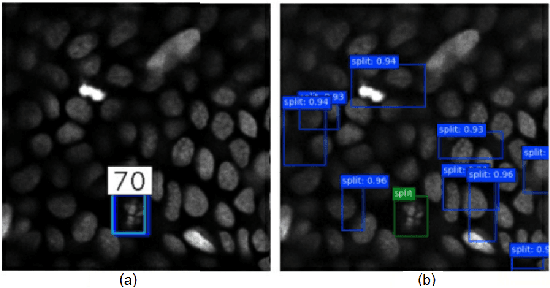 Figure 4 for A Cascade of 2.5D CNN and LSTM Network for Mitotic Cell Detection in 4D Microscopy Image