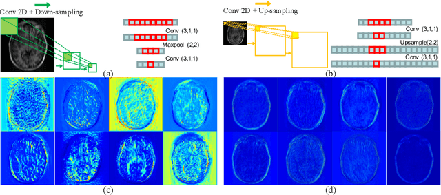 Figure 1 for Over-and-Under Complete Convolutional RNN for MRI Reconstruction