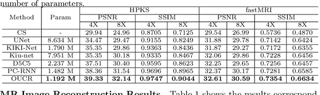 Figure 2 for Over-and-Under Complete Convolutional RNN for MRI Reconstruction