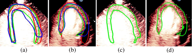 Figure 1 for Segmentation with Multiple Acceptable Annotations: A Case Study of Myocardial Segmentation in Contrast Echocardiography