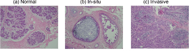 Figure 4 for How Much Off-The-Shelf Knowledge Is Transferable From Natural Images To Pathology Images?