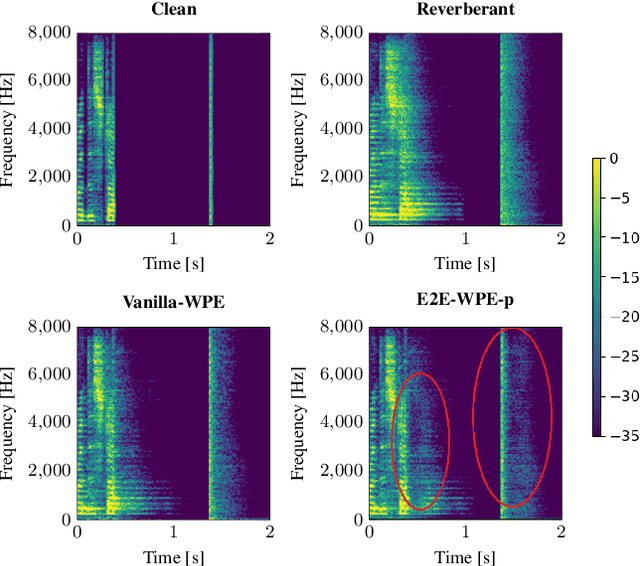 Figure 4 for Customizable End-to-end Optimization of Online Neural Network-supported Dereverberation for Hearing Devices