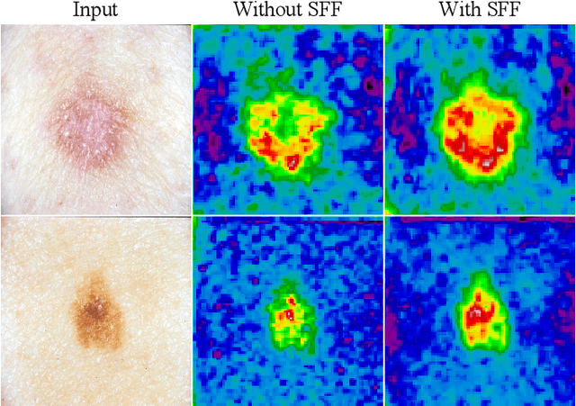 Figure 3 for Salient Skin Lesion Segmentation via Dilated Scale-Wise Feature Fusion Network
