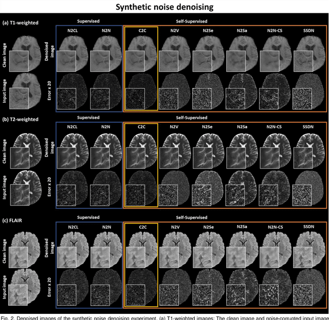 Figure 2 for Coil2Coil: Self-supervised MR image denoising using phased-array coil images