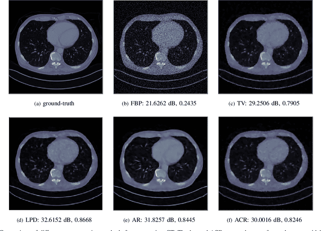 Figure 1 for Learned convex regularizers for inverse problems