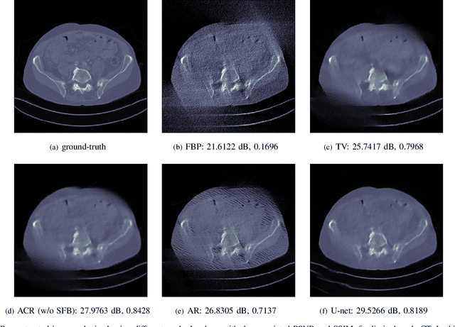 Figure 2 for Learned convex regularizers for inverse problems