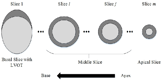 Figure 2 for Automatic Assessment of Full Left Ventricular Coverage in Cardiac Cine Magnetic Resonance Imaging with Fisher-Discriminative 3D CNN