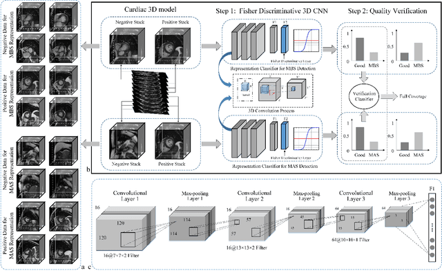 Figure 3 for Automatic Assessment of Full Left Ventricular Coverage in Cardiac Cine Magnetic Resonance Imaging with Fisher-Discriminative 3D CNN