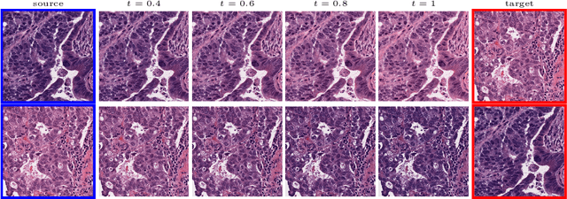 Figure 1 for Multimarginal Wasserstein Barycenter for Stain Normalization and Augmentation
