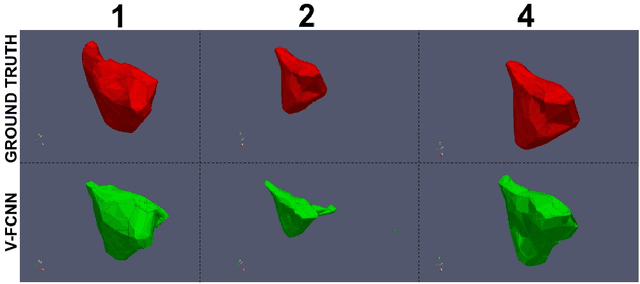 Figure 4 for V-FCNN: Volumetric Fully Convolution Neural Network For Automatic Atrial Segmentation