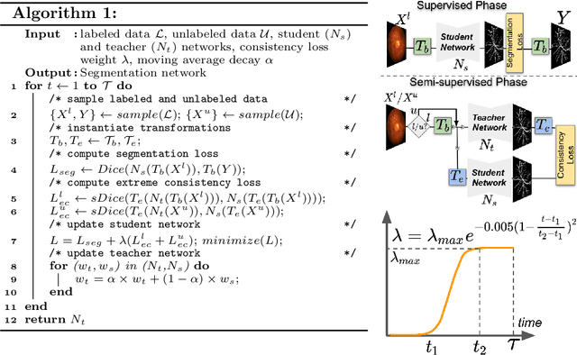 Figure 1 for Extreme Consistency: Overcoming Annotation Scarcity and Domain Shifts