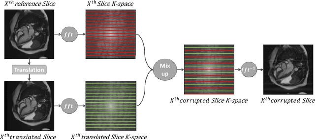 Figure 2 for Automatic Multi-Class Cardiovascular Magnetic Resonance Image Quality Assessment using Unsupervised Domain Adaptation in Spatial and Frequency Domains