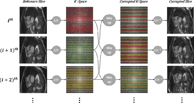 Figure 3 for Automatic Multi-Class Cardiovascular Magnetic Resonance Image Quality Assessment using Unsupervised Domain Adaptation in Spatial and Frequency Domains