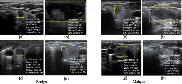 Figure 1 for Multi-Attribute Attention Network for Interpretable Diagnosis of Thyroid Nodules in Ultrasound Images