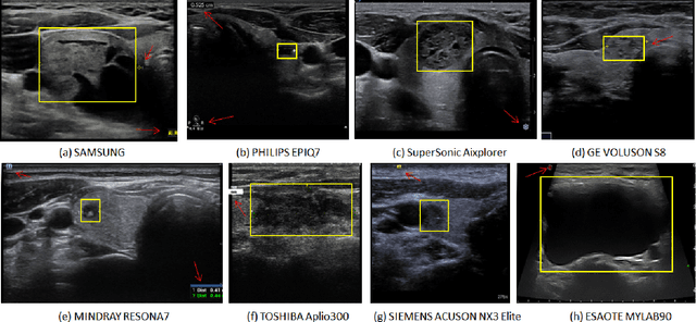 Figure 4 for Multi-Attribute Attention Network for Interpretable Diagnosis of Thyroid Nodules in Ultrasound Images