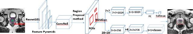 Figure 1 for Segmentation of the Prostatic Gland and the Intraprostatic Lesions on Multiparametic MRI Using Mask-RCNN