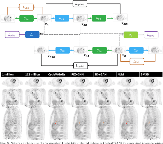 Figure 3 for Artificial Intelligence-Based Image Enhancement in PET Imaging: Noise Reduction and Resolution Enhancement