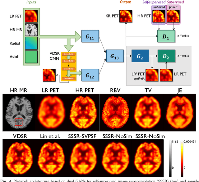 Figure 4 for Artificial Intelligence-Based Image Enhancement in PET Imaging: Noise Reduction and Resolution Enhancement