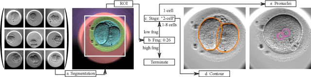 Figure 1 for Automated Measurements of Key Morphological Features of Human Embryos for IVF