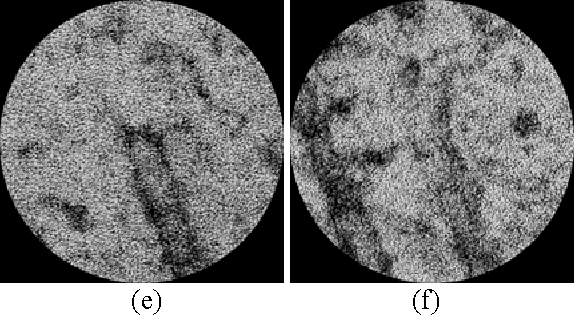 Figure 4 for Alignment of Microtubule Imagery