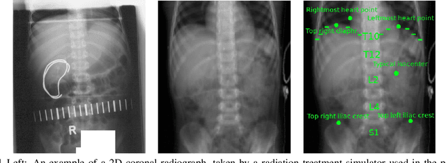 Figure 1 for Machine learning for automatic construction of pseudo-realistic pediatric abdominal phantoms