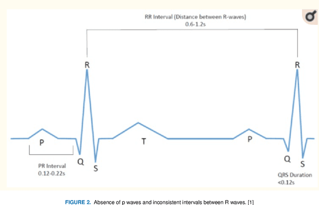 Figure 2 for Analysis of ECG data to detect Atrial Fibrillation