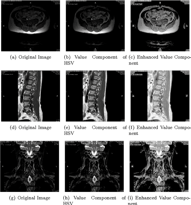 Figure 4 for An Improved Approach for Contrast Enhancement of Spinal Cord Images based on Multiscale Retinex Algorithm