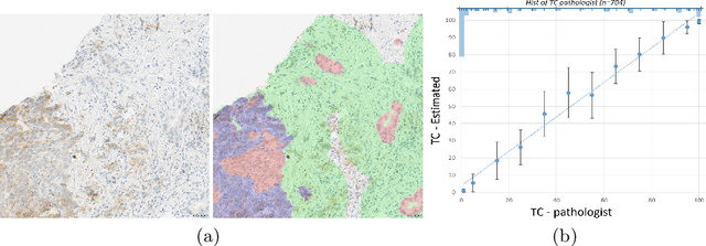 Figure 4 for DASGAN -- Joint Domain Adaptation and Segmentation for the Analysis of Epithelial Regions in Histopathology PD-L1 Images
