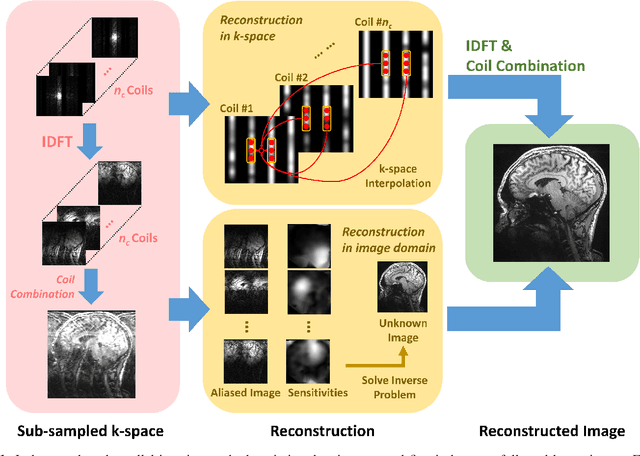 Figure 1 for Deep Learning Methods for Parallel Magnetic Resonance Image Reconstruction