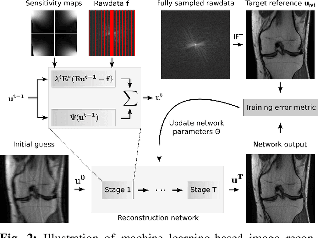 Figure 2 for Deep Learning Methods for Parallel Magnetic Resonance Image Reconstruction