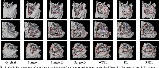 Figure 4 for Learning Non-Unique Segmentation with Reward-Penalty Dice Loss