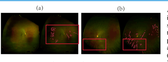 Figure 2 for Leveraging Regular Fundus Images for Training UWF Fundus Diagnosis Models via Adversarial Learning and Pseudo-Labeling