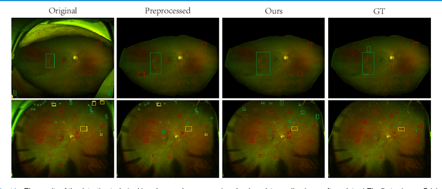 Figure 3 for Leveraging Regular Fundus Images for Training UWF Fundus Diagnosis Models via Adversarial Learning and Pseudo-Labeling