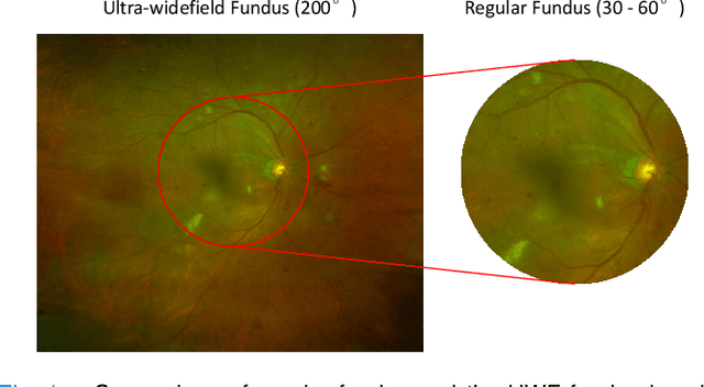 Figure 1 for Leveraging Regular Fundus Images for Training UWF Fundus Diagnosis Models via Adversarial Learning and Pseudo-Labeling