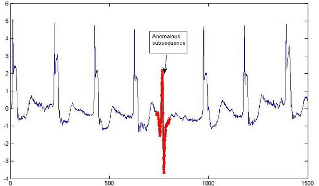 Figure 1 for Anomaly Detection in Big Data