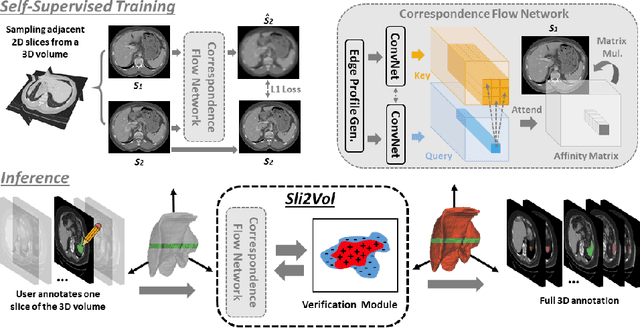 Figure 1 for Sli2Vol: Annotate a 3D Volume from a Single Slice with Self-Supervised Learning